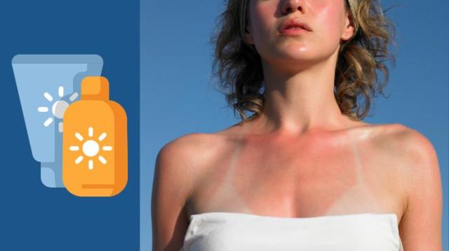5 Effective Home Remedies to Treat a Painful Sunburn