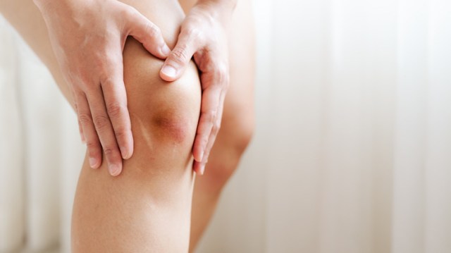 5 Ways to Reduce Bruising and Swelling